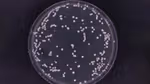 Feature image - Could this bacteria be the root cause of dandruff?